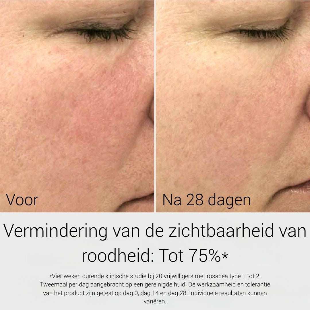 Before & After G.M. Collin