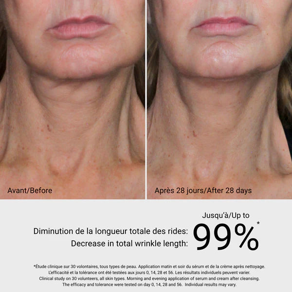 Before & After 